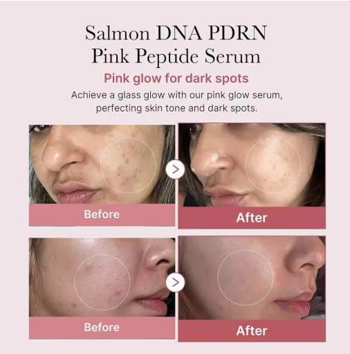 GlowErase™ Dark Spot Serum